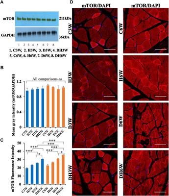 The impact of heat therapy on neuromuscular function and muscle atrophy in diabetic rats